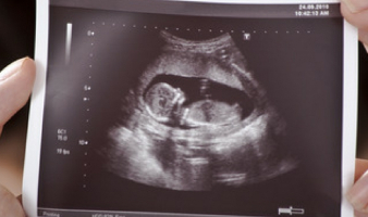 Planned Parenthood Turns 100